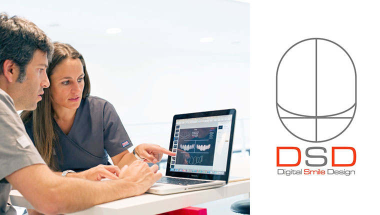 digital-smile-design_protesis-dental-maxilifacial_urbandental-1
