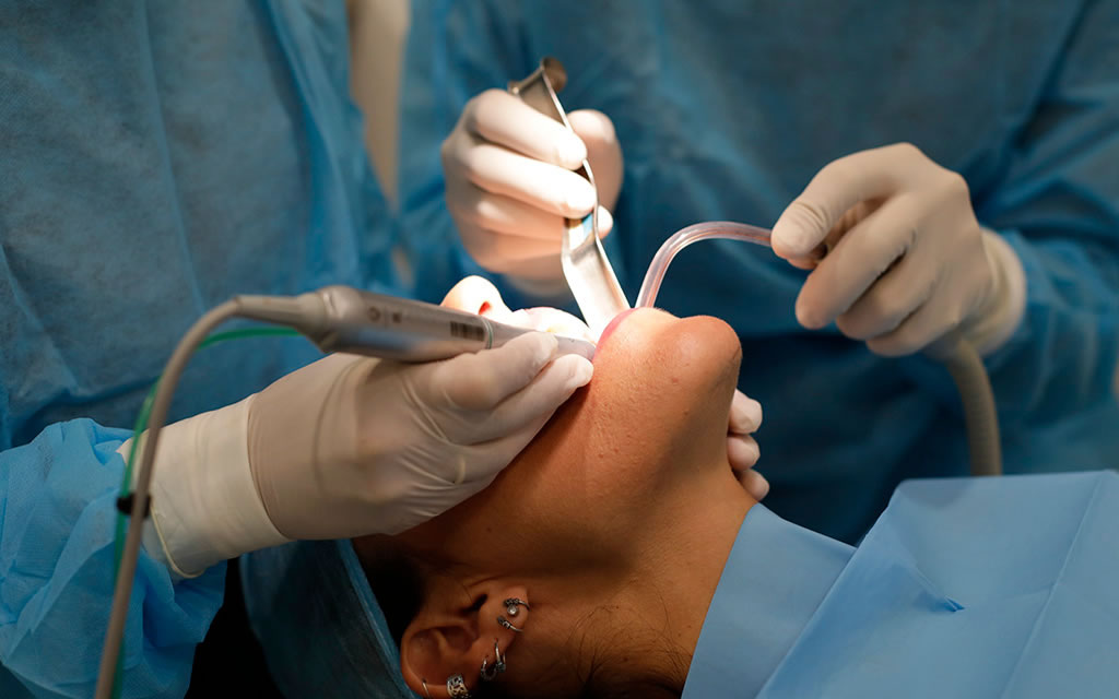 implantes-dentales-inf2-urbandental